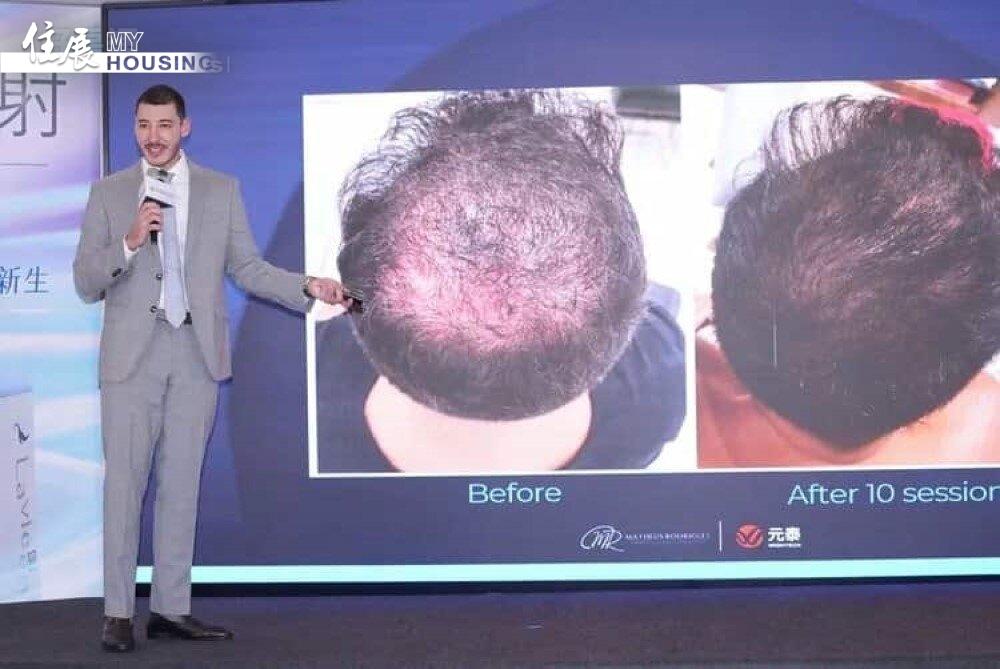 ▼拉髮密雷射已累積超過300件臨床案例，成為頭皮修復領域的焦點技術。圖/愛爾麗集團提供